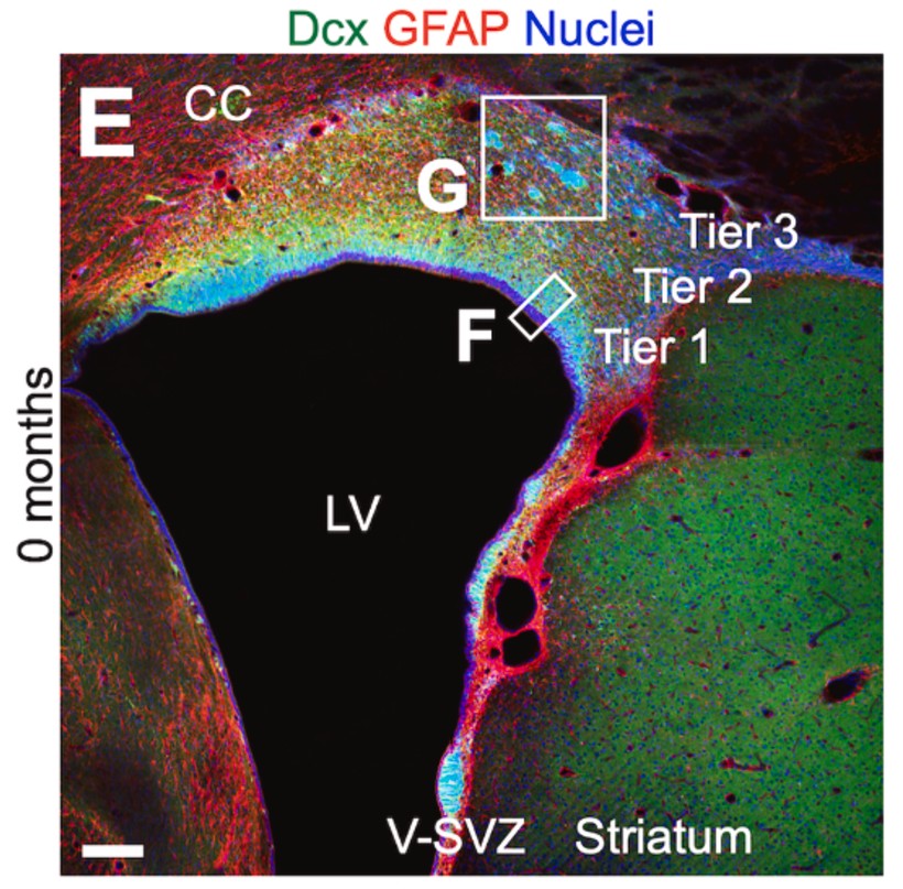 New paper on the cytoarchitecture of the postnatal V-SVZ in microminipigs