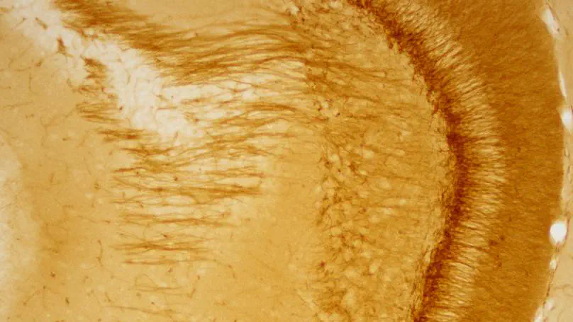 NeuroPlaNe Lab website is now live